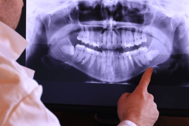 Best Emergency Gum Treatment in Dunbar, WV