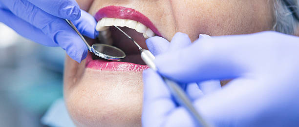 Best Emergency Dental Care for Broken or Chipped Teeth in Dunbar, WV